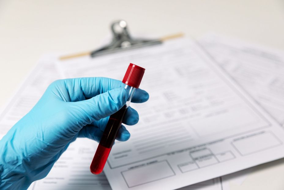 Impulso al diagnóstico de cáncer de próstata: investigadores descubren la causa de la metástasis. Foto: Europa Press Impulso al diagnóstico de cáncer de próstata: investigadores descubren la causa de la metástasis. Foto: Europa Press