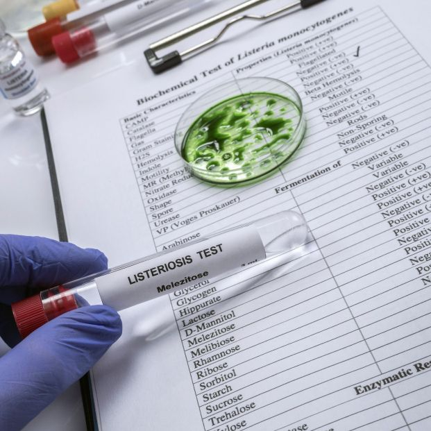 El riesgo de infectarse de listeria bebiendo leche cruda es mayor en invierno El riesgo de infectarse de listeria bebiendo leche cruda es mayor en invierno
