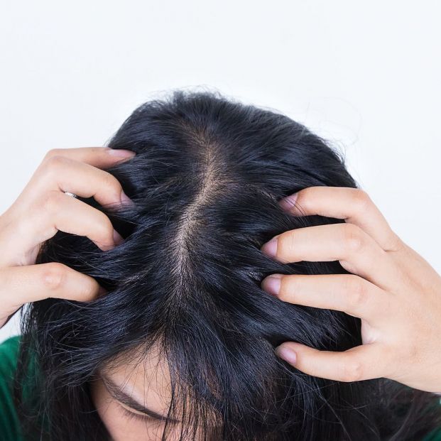 Dermatitis seborreica Dermatitis seborreica