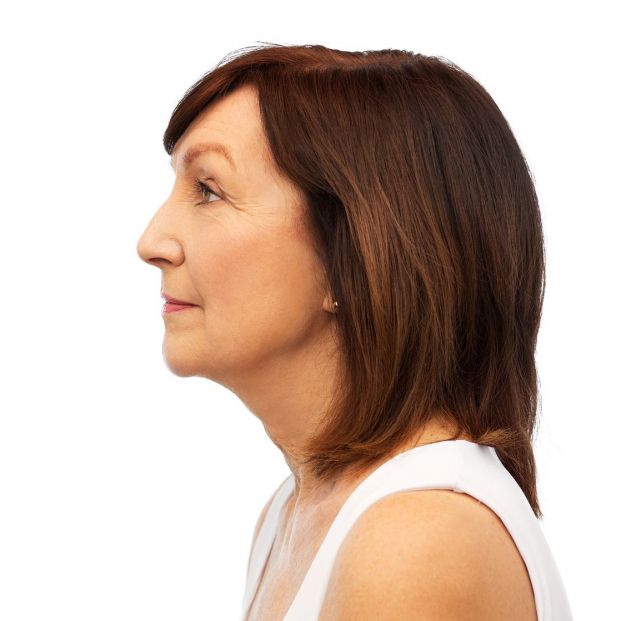 Es posible la rinoplastia en personas mayores Es posible la rinoplastia en personas mayores