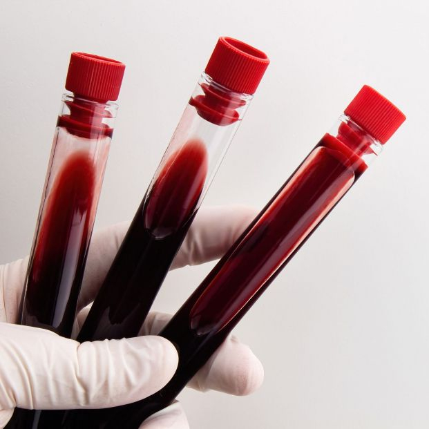 Descubren a dos personas con “sangre dorada” Descubren a dos personas con “sangre dorada”