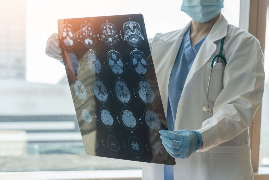 Un estudio confirma el uso de un biomarcador en sangre para detectar alzhéimer en fases iniciales