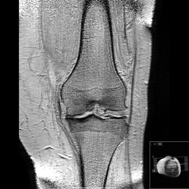 EuropaPress 1586427 30 pacientes artrosis muestra mayor sensibilidad dolor