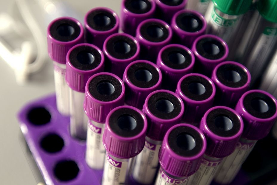 EuropaPress 4988199 imagen tubos analitica EuropaPress 4988199 imagen tubos analitica