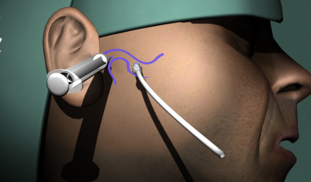 La primera APP del mundo que enseña a operar mediante videojuegos es de origen extremeño