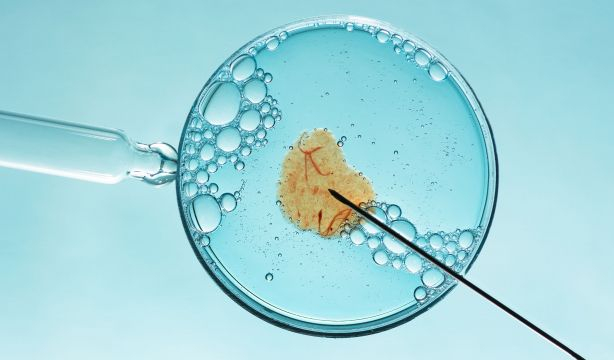 La OMS alerta de un nuevo problema de salud global: 1 de cada 6 personas sufre infertilidad