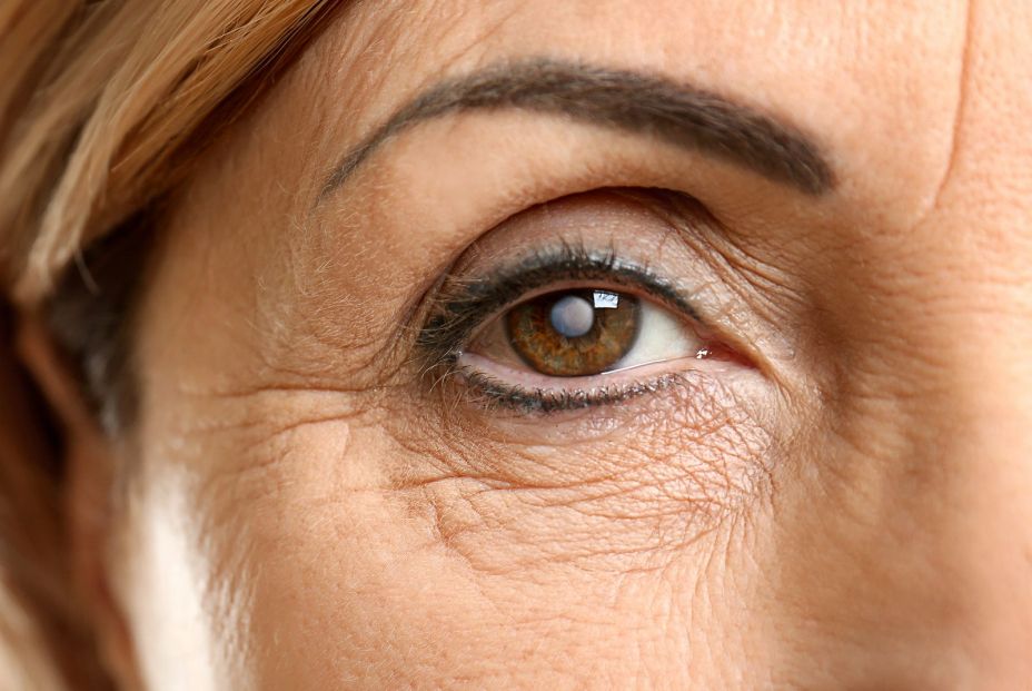 <lista de esperalas cataratas <lista de esperalas cataratas