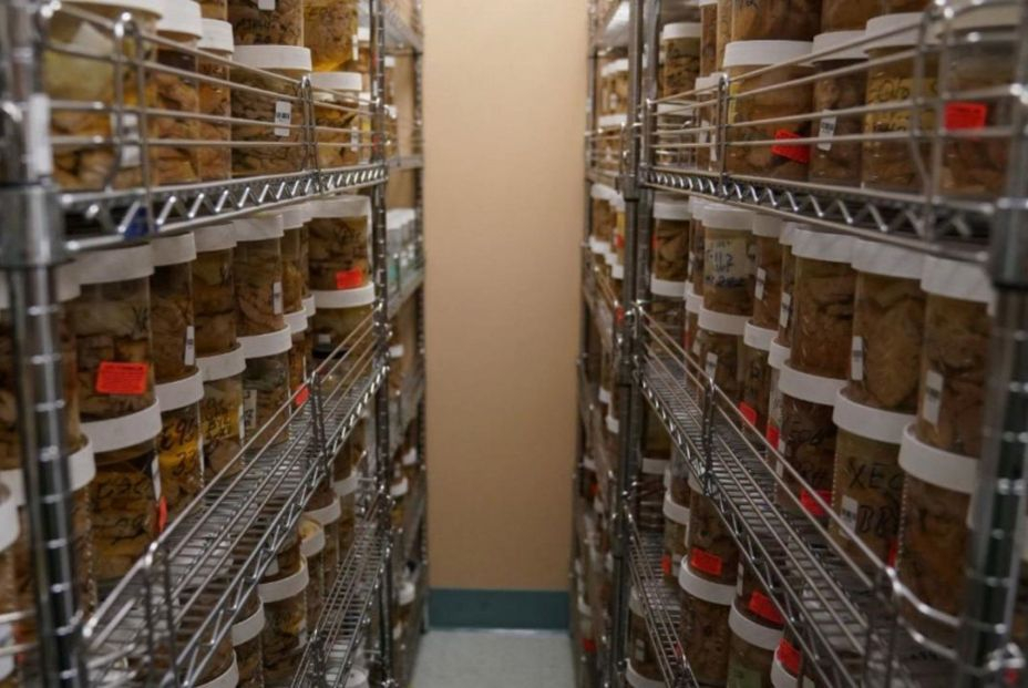 Avances en el alzhéimer : se descubren las claves de los cerebros de los pacientes 'resistentes' 