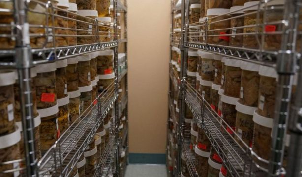 Avances en el alzhéimer : se descubren las claves de los cerebros de los pacientes 'resistentes' 