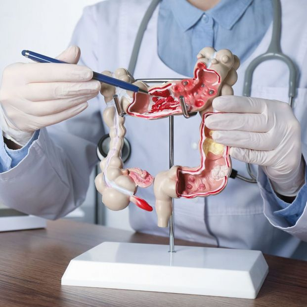 Los nuevos síntomas que se relacionan con el cáncer de colon Los nuevos síntomas que se relacionan con el cáncer de colon