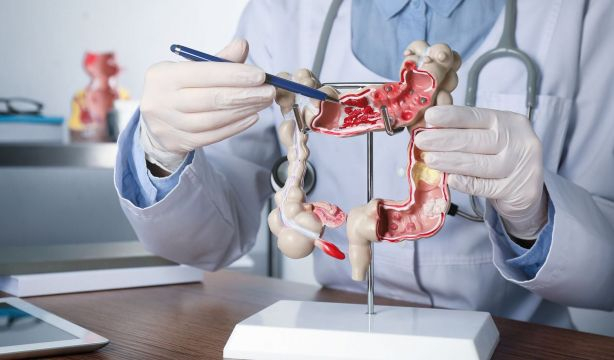 Científicos españoles descubren un mecanismo molecular que inicia el cáncer de colon. Bigstock