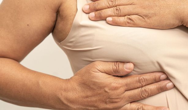 Cáncer de mama: ¿Qué es el ganglio centinela? ¿Qué es el linfedema y cuándo aparece?