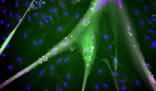 Células madre inmortales para producir carne en masa sin ganado