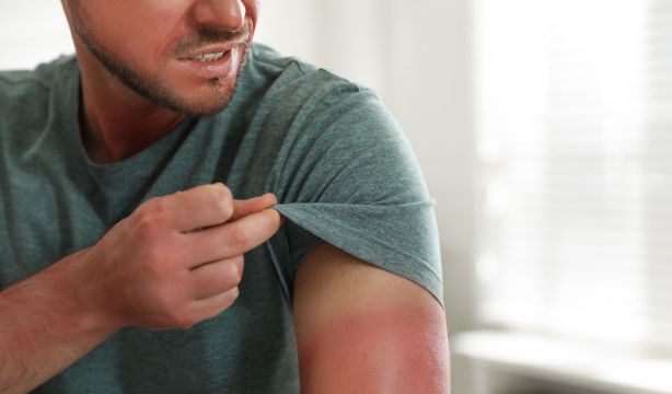 Un componente de la melanina, clave en la protección solar