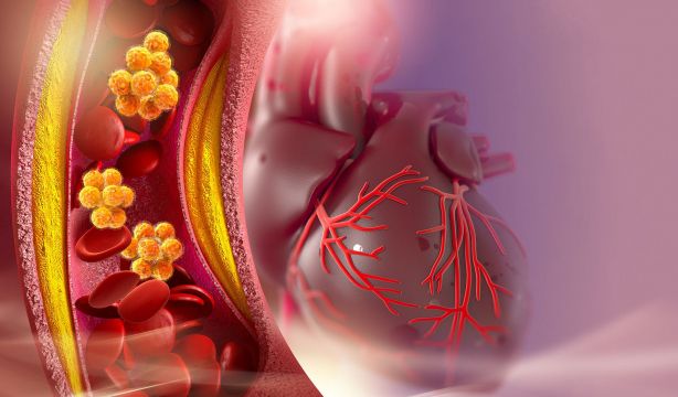 Un estudio apunta que tener colesterol o hipertensión aumenta el riesgo de Alzheimer