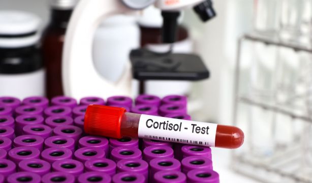 El impacto del cortisol en nuestra salud