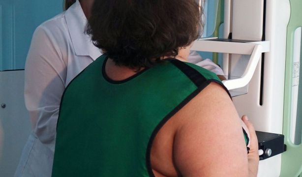 Mamografía: ¿Tiene riesgos? ¿Cuándo hay que hacerla? ¿Por qué no se recomienda antes de los 40 años?