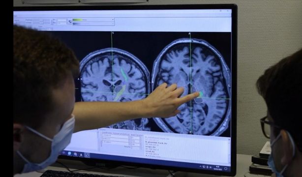 Estos cuatro síntomas avisan de la enfermedad de Parkinson