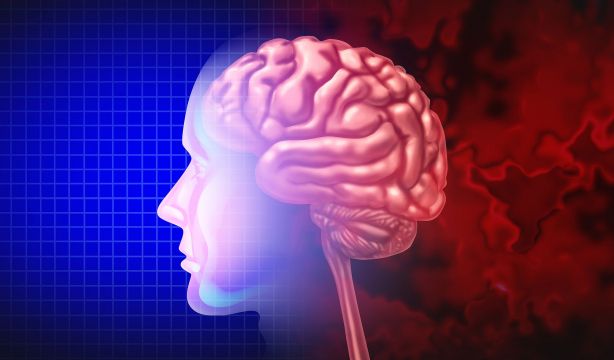 Descubren que las proteínas humanas que causan el alzhéimer provocan más daño que las de ratón