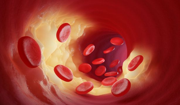  El desconocido colesterol que se hereda y pone en riesgo a una de cada cinco personas