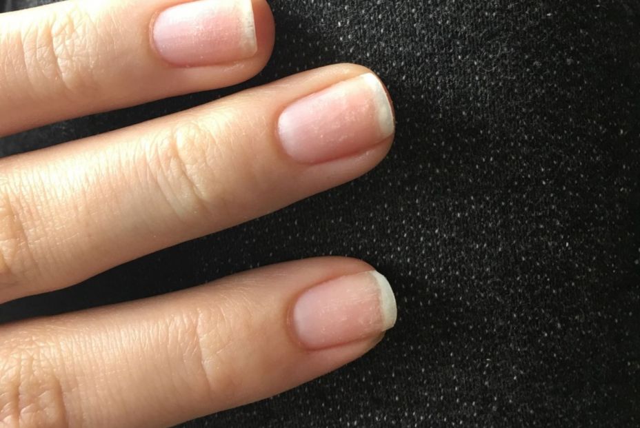 Cómo puedes fortalecer tus uñas (Pxhere) Cómo puedes fortalecer tus uñas (Pxhere)