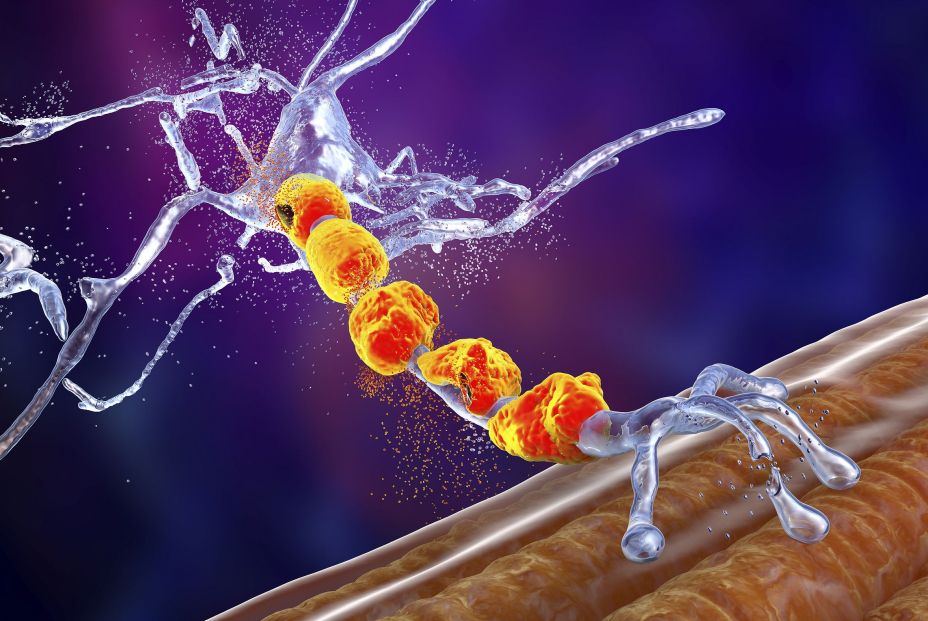 bigstock Degradation Of Motor Neurons420881894
