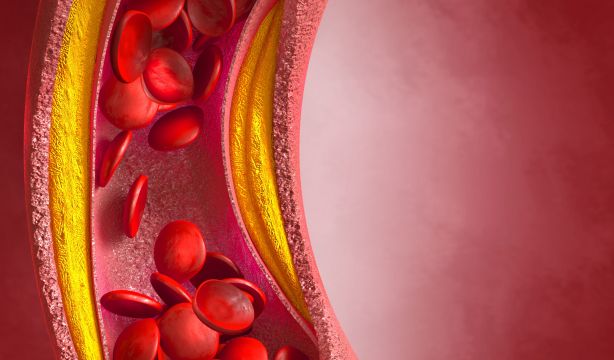 Crean un algoritmo de IA capaz de diagnosticar infartos: acierta al 99%