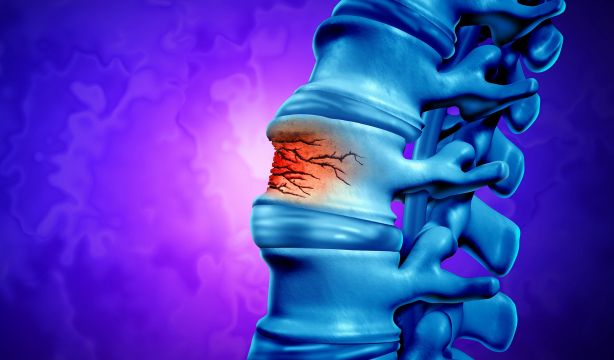 La soledad también afecta negativamente a la salud ósea