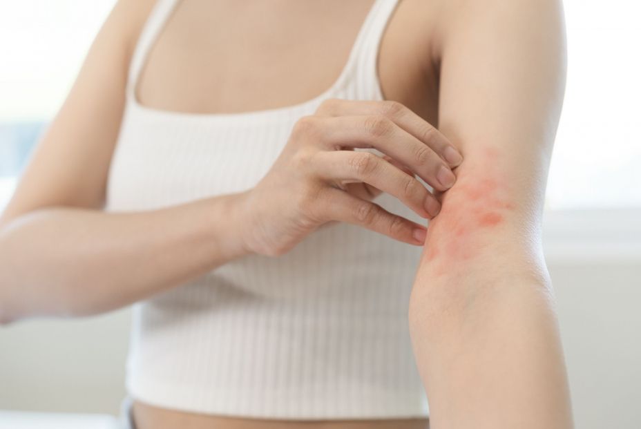 bigstock Dermatology Asian Young Woman476948107 bigstock Dermatology Asian Young Woman476948107