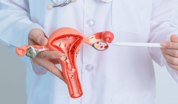 Estas profesiones tienen más riesgo de sufrir cáncer de ovario