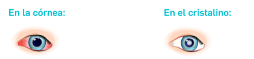 Daños en la córnea y en el cristalino Daños en la córnea y en el cristalino
