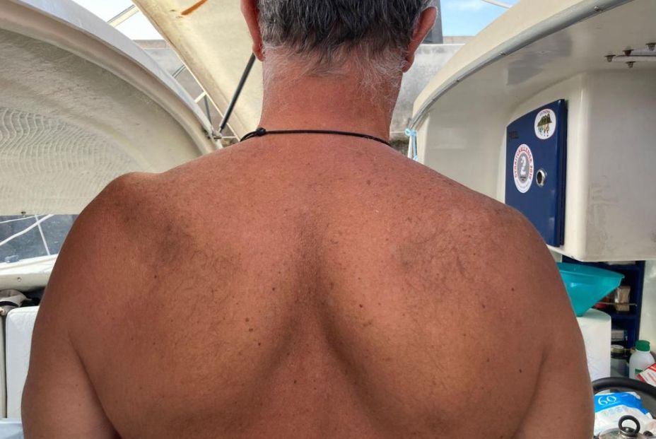 Una lesión trunca el sueño de dar la vuelta al mundo en barco en solitario de Ángel, con 62 años