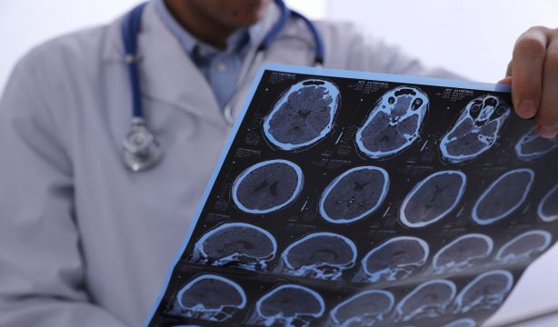 Los últimos estudios sobre el alzhéimer confirman la importancia de la detección precoz