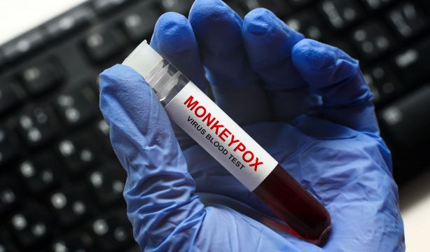 La UE se pronuncia sobre la nueva cepa de la viruela del mono: el riesgo es "bajo" para Europa