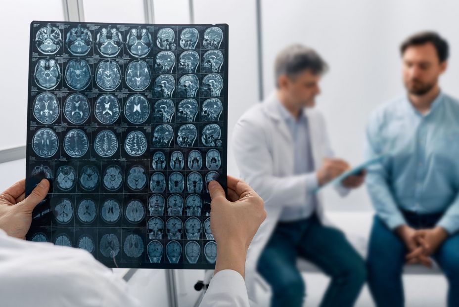 La migraña afecta a más de 5 millones de personas en España