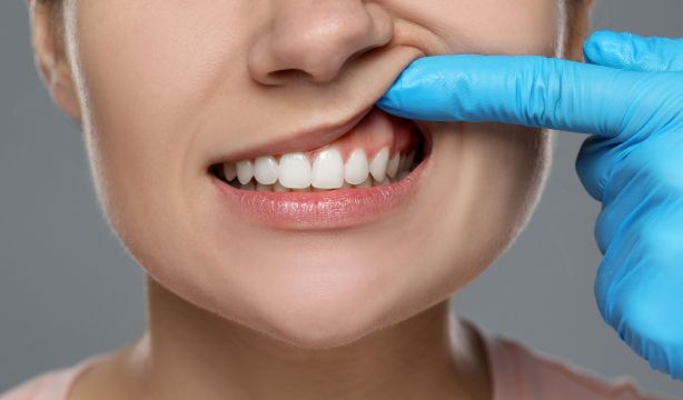 ¿Sensibilidad dental? Cuatro consejos para evitarla
