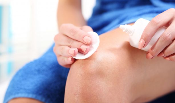 Este es el mejor antiséptico para curar heridas y quemaduras