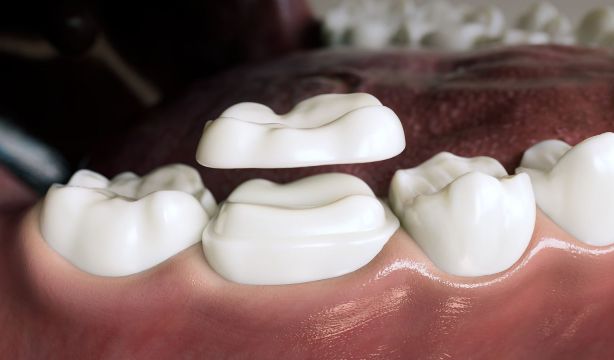 Desarrollan el primer fármaco que hace crecer nuevos dientes