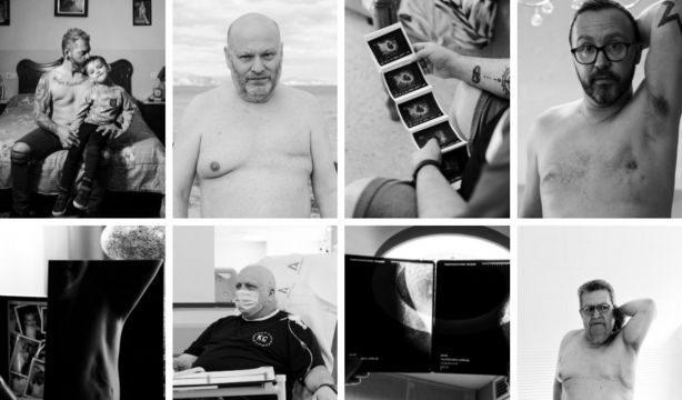 ‘La voz de la inclusión’, una campaña para visibilizar el cáncer de mama masculino