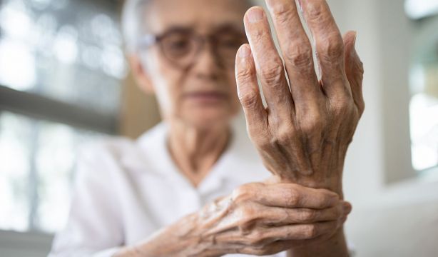 Un medicamento asequible y existente podría ayudar a las personas con artrosis dolorosa en la mano