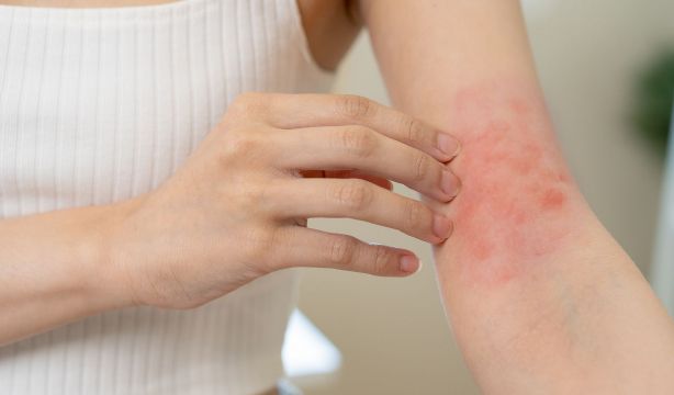 Descubren el mecanismo que provoca el picor, lo que abre la puerta a nuevos fármacos