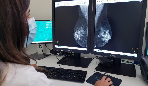 Las comunidades siguen sin aumentar la edad en cribados de cáncer de mama: "La detección es clave". Foto: Europa Press