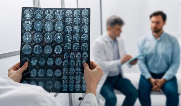 El gorro inteligente que detecta con precisión si se está sufriendo un ictus 