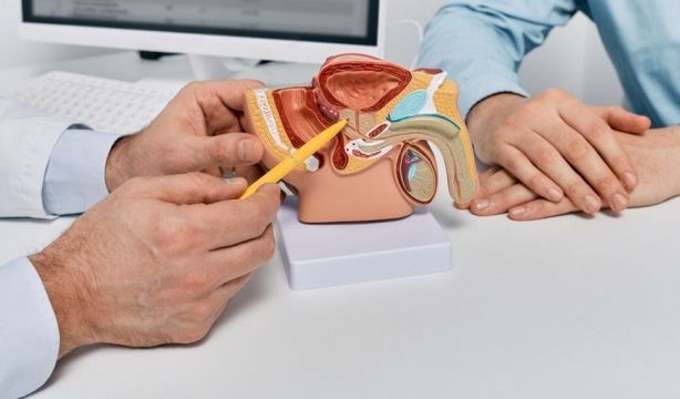 El 87% de las personas diagnosticadas con cáncer de próstata padecen obesidad