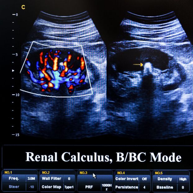 Ultrasonografía Ultrasonografía