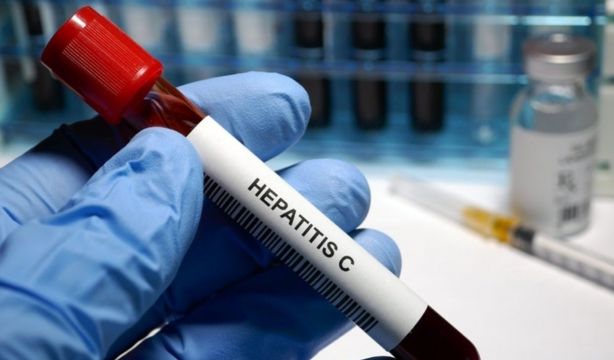 Eliminar espontáneamente la hepatitis C produce más riesgo de sufrir enfermedades (Europa Press)