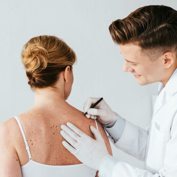 Manchas en la piel Manchas en la piel