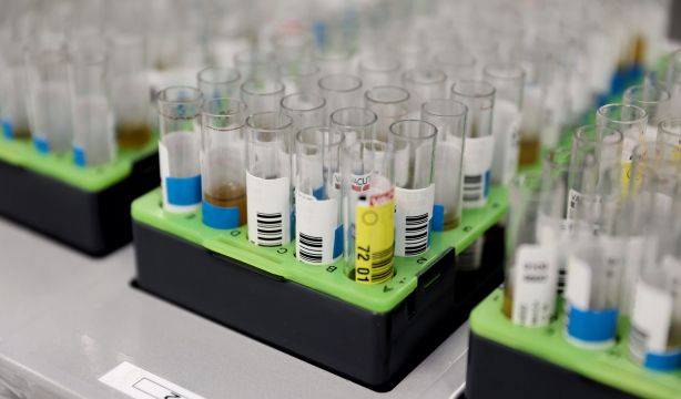 Los laboratorios de hospitales públicos españoles están hoy más preparados que antes de la pandemia