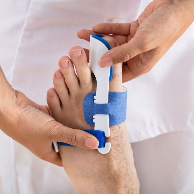 Alternativas a la operación de juanetes