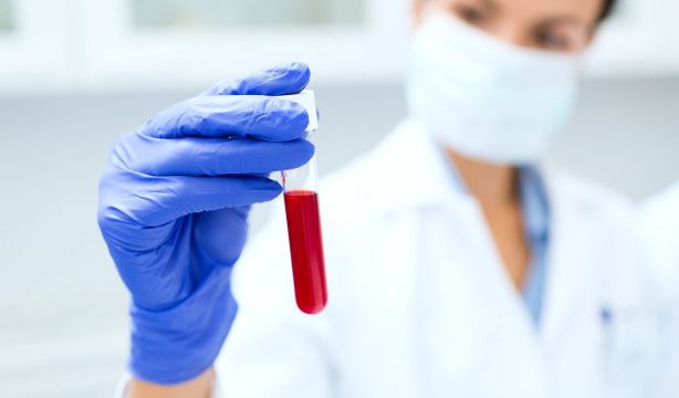 Desarrollan una analítica de sangre que puede diagnosticar el alzhéimer con una precisión del 90%
